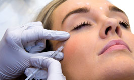 نحوه کارتزریق فیلر Restylane